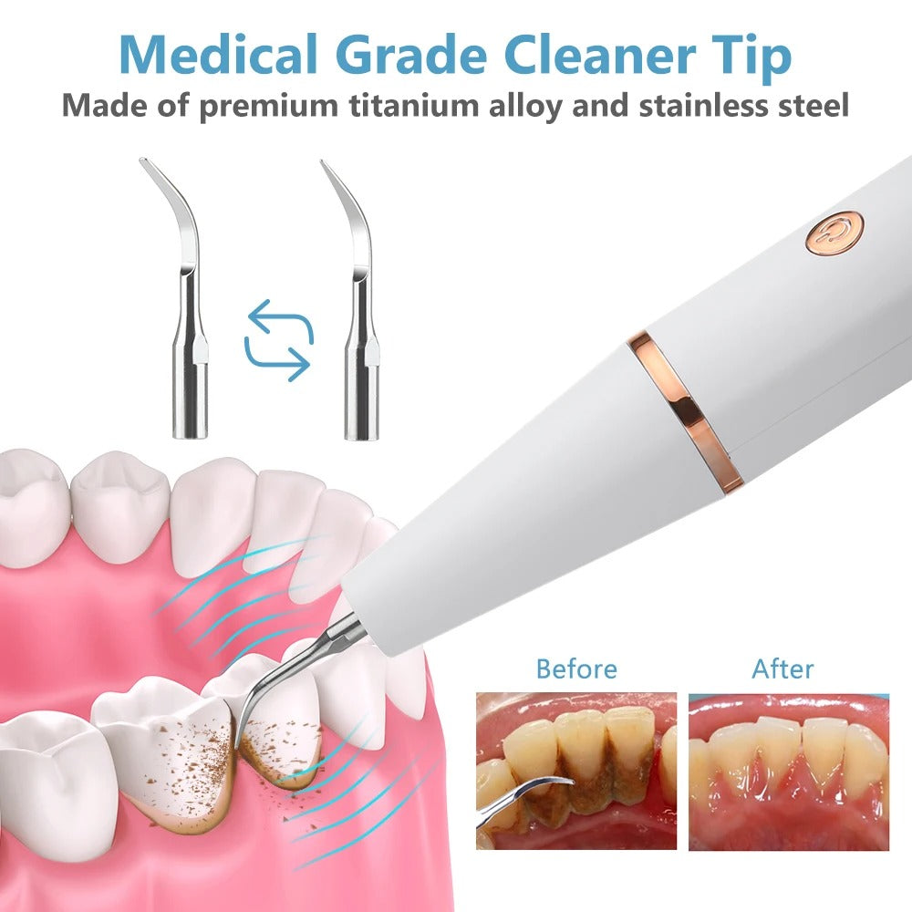 Ultrasonic Plaque Remover - Deep Teeth Cleaning Device