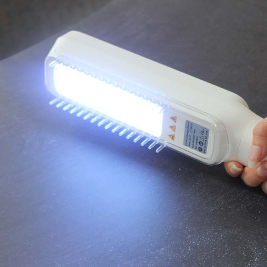 "Compact handheld UVB phototherapy lamp for psoriasis, vitiligo treatment; ideal for scalp, hands, joints; travel-friendly."