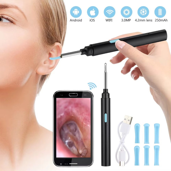 Smart Visual Earwax Removal Tool with LED Camera