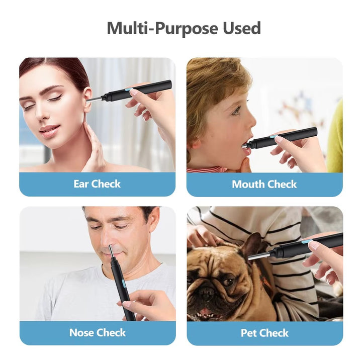 Smart Visual Earwax Removal Tool with LED Camera