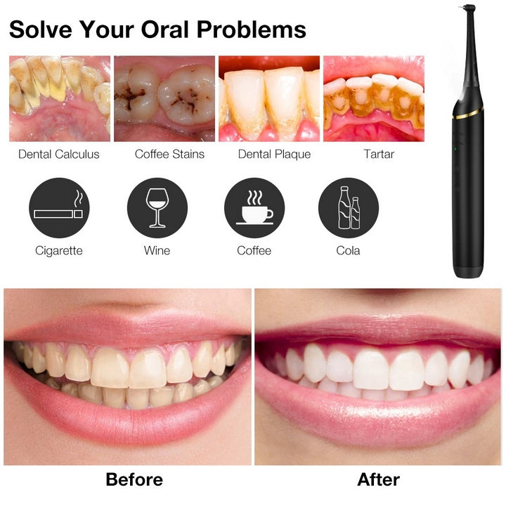 "Rechargeable ultrasonic dental scaler with sleek design, high-frequency vibrations, USB rechargeable for effective oral care