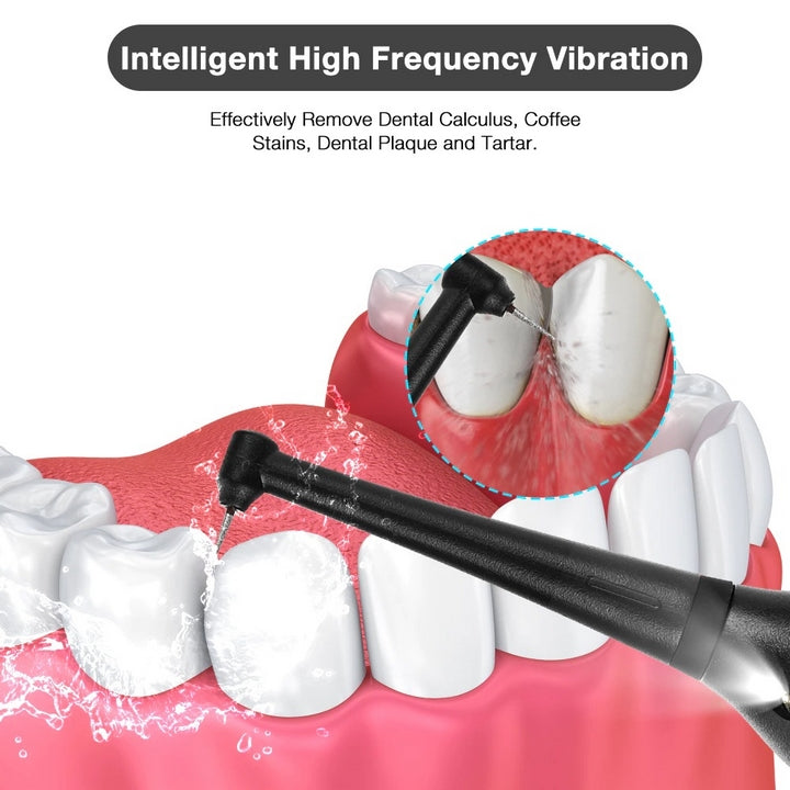 "Rechargeable ultrasonic dental scaler with sleek design, high-frequency vibrations, USB rechargeable for effective oral care