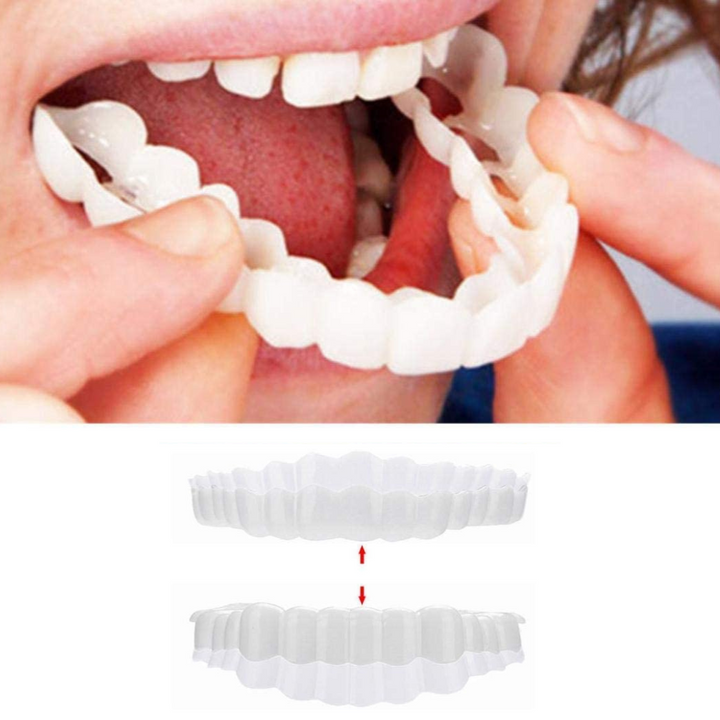 "Smile veneer set with upper and lower pieces, natural white finish, for beauty and wellbeing, transforms imperfect teeth."