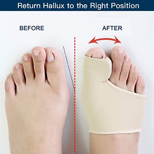 "Unisex bunion relief silicone corrector with gel padding, offers pain relief and toe alignment with durable medical grade si