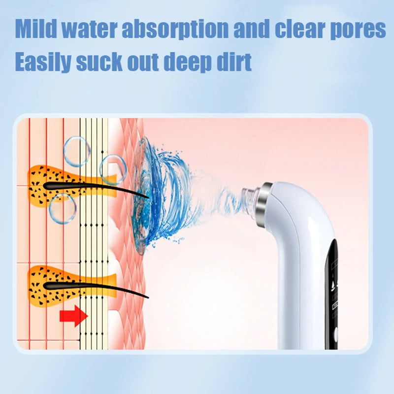 "Unisex electric blackhead remover vacuum, sleek design, adjustable suction for skin cleansing, front view."