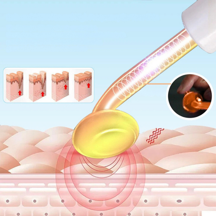 "Unisex high-frequency skin tightening wand for wrinkle reduction and acne treatment, featuring compact neon argon design."